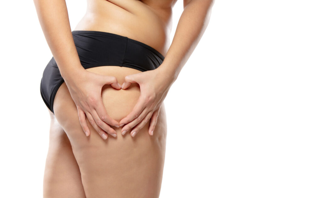 Éliminer la cellulite des cuisses