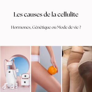 causes de cellulite