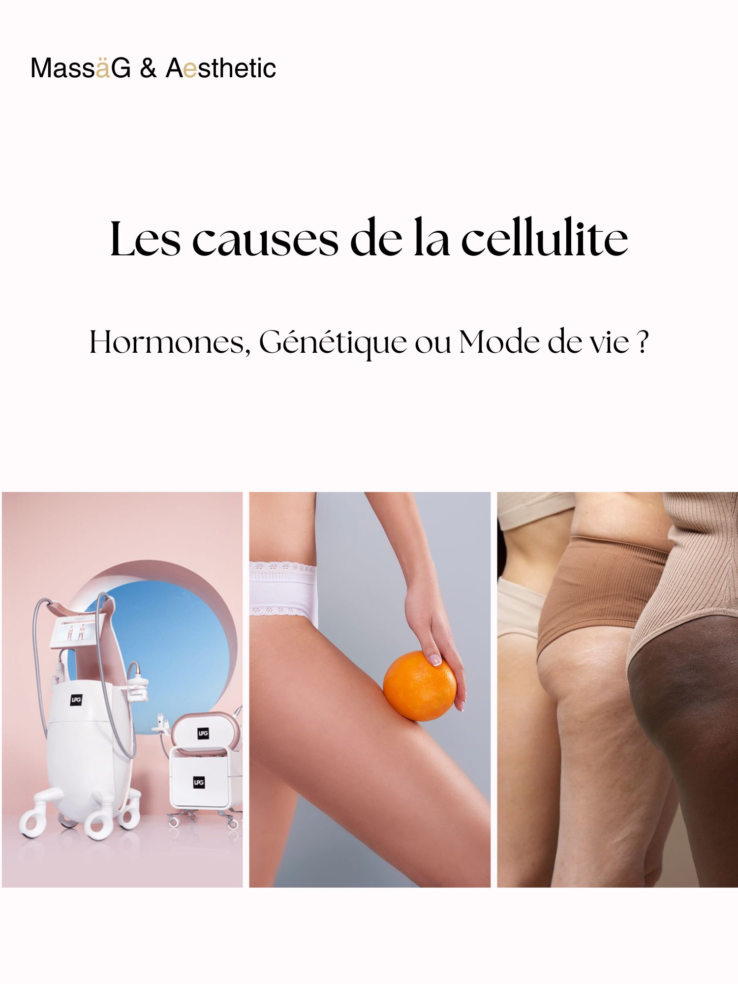 Cause de la cellulite : qu’est-ce qui provoque la cellulite ?
